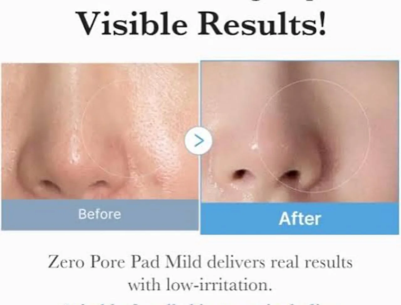 Medicube Zero Pore Pad 2.0