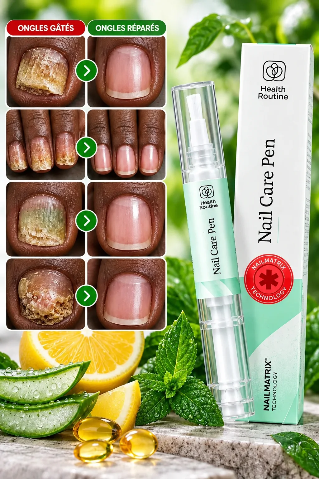 Réparez vos ongles abîmés, décolorés, cassants et atteints de mycoses avant qu’elles ne s’aggravent ! Découvrez Répar’Ongles™