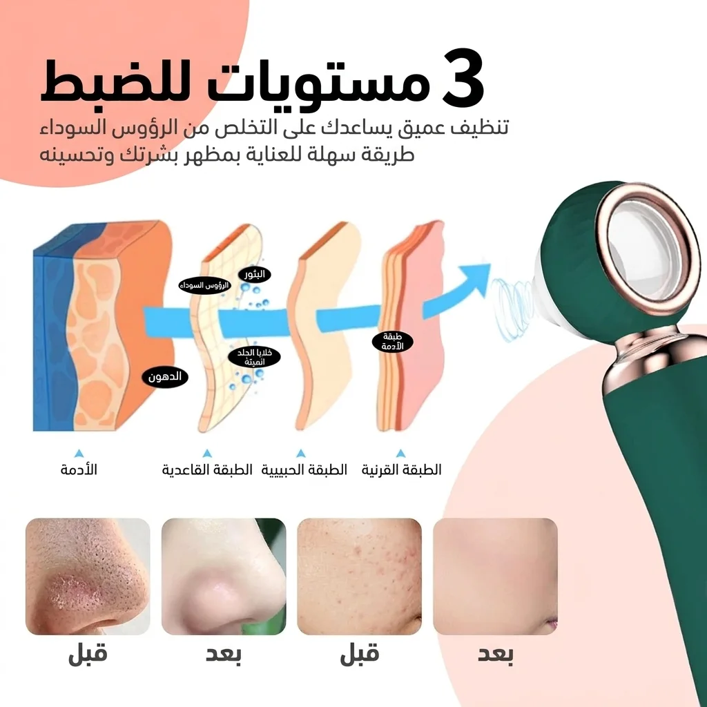مزيل الرؤوس السوداء