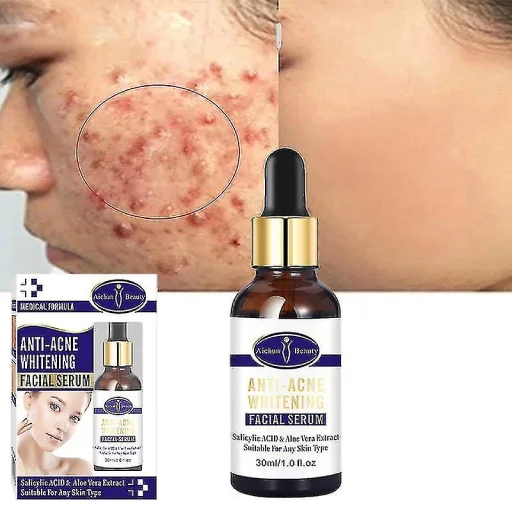 ✨ Sérum Visage Anti-Acné Aichun Beauty – Pour une Peau Plus Nette et Éclatante 😣 Les boutons et imperfections vous gênent ?