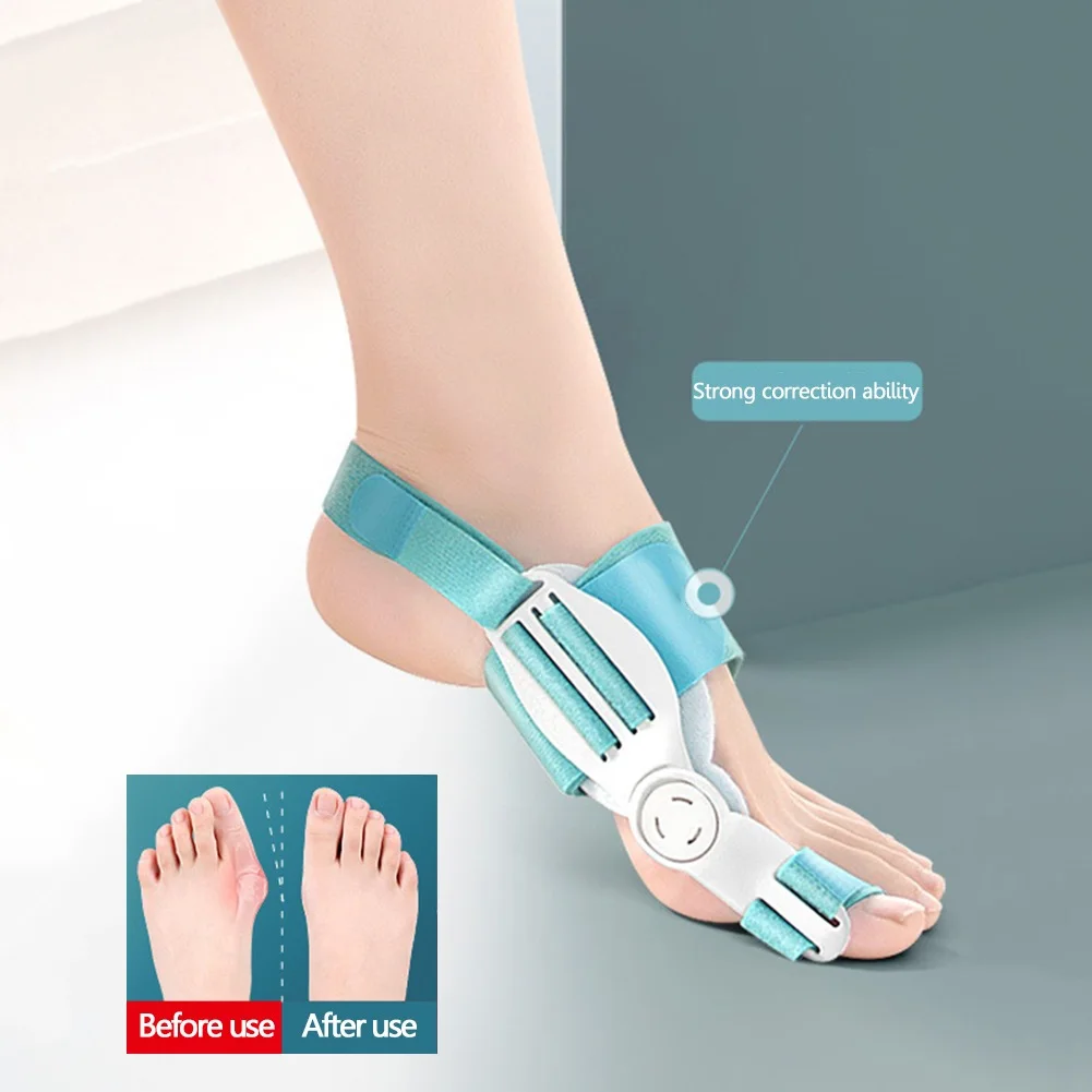 🦶 Toe Straightener Bunion Corrector – مصحّح إبهام القدم وفاصل أصابع لتقويم الأصابع