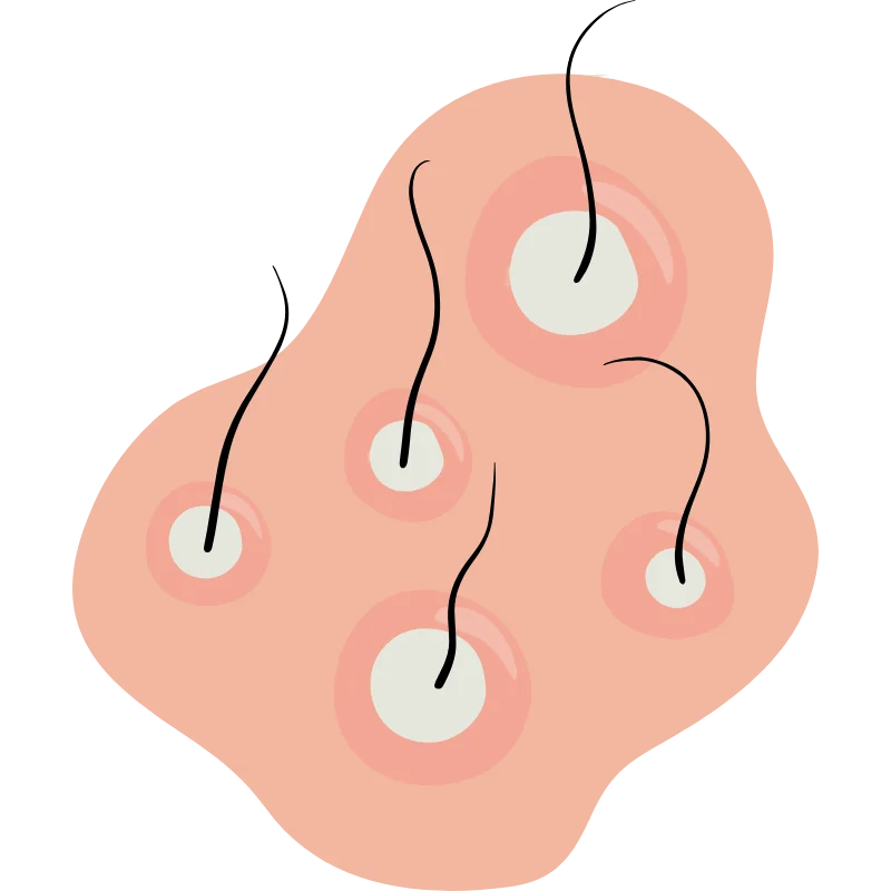 تنقية فروة الرأس