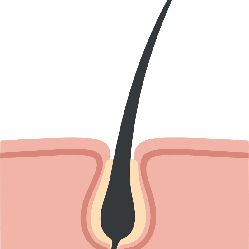 تقوية من الجذور