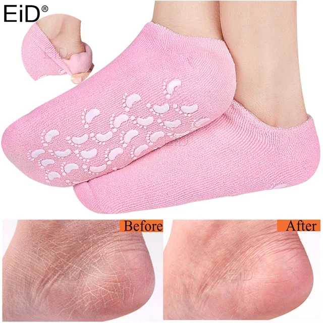 باك العناية بالقدمين 🧦💅 جوارب جل + جهاز كهربائي 2 سرعات — اطلب العرض الآن والدفع عند الاستلام