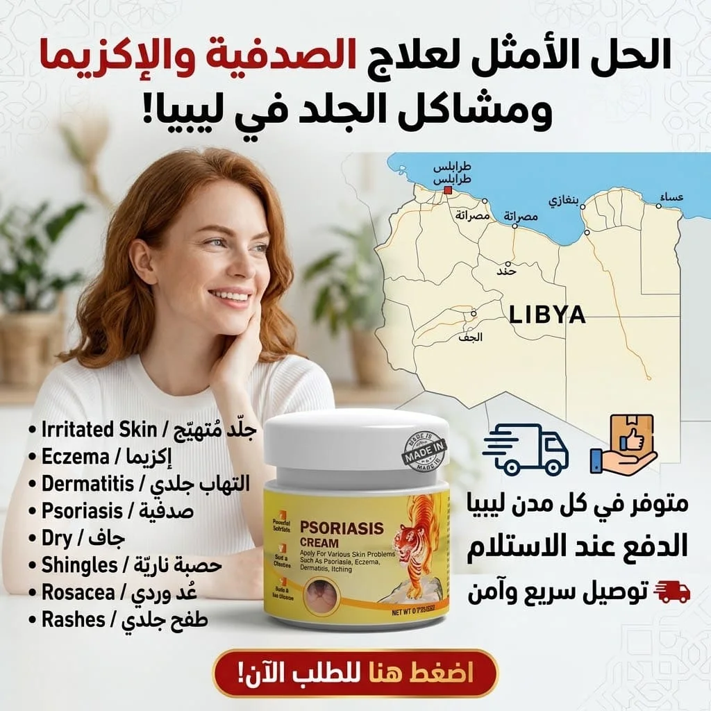 كريم علاج الصدفية والأكزيما