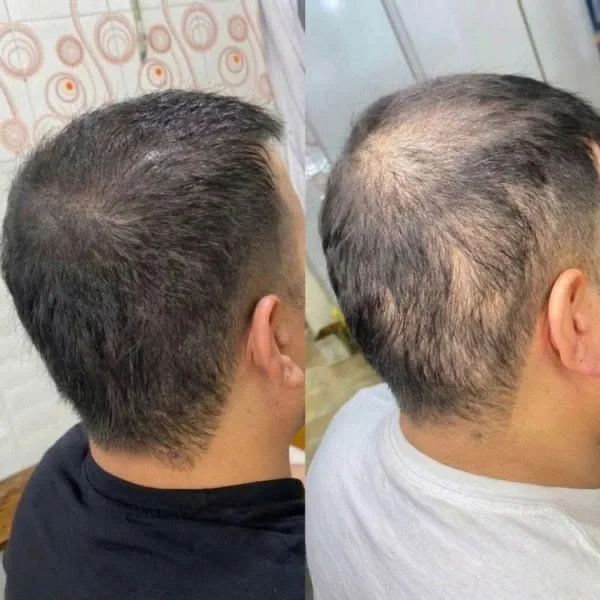 زيت تقوية الشعر