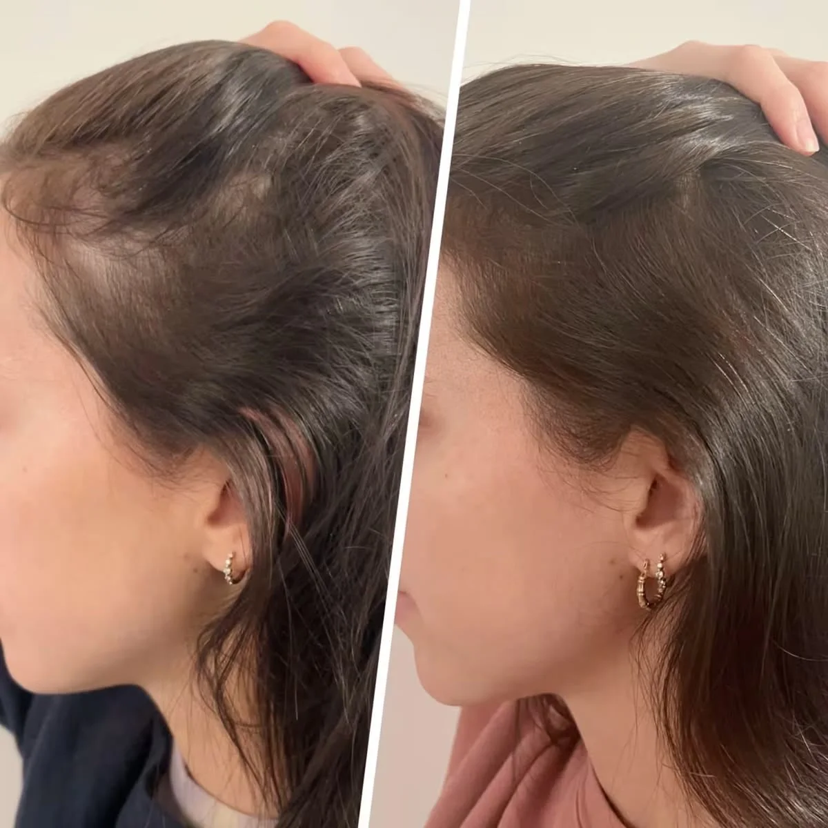 زيت تقوية الشعر