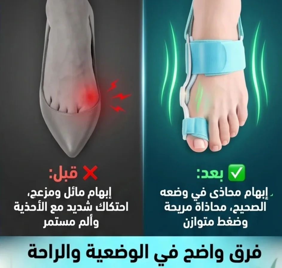 هل يؤلمك اصبع  قدمك؟  الحل بين يديك مع منتج مصحح اصبع القدم الفعال  لأقدام أكثر راحة واستقامة طوال اليوم